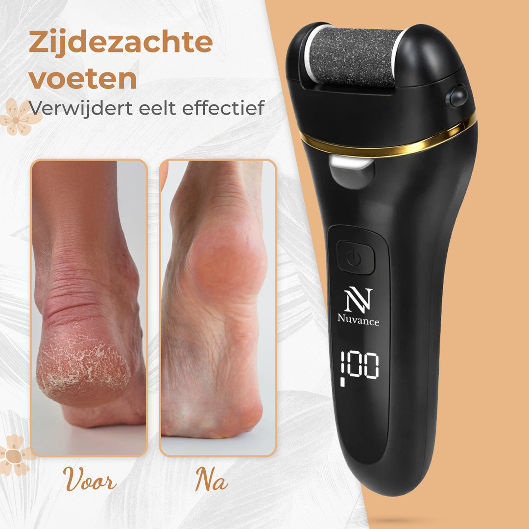 Eeltverwijderaar