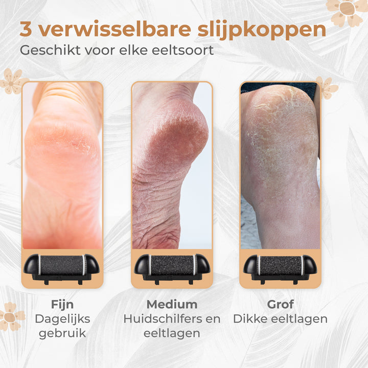 Eeltverwijderaar